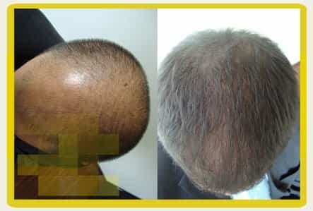 Geovani Bojanini Image Profile Before After