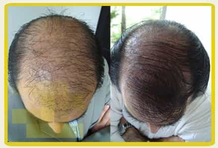 Geovani Bojanini Image Profile Before After