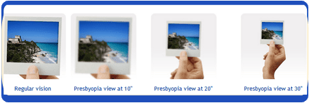 Presbyopia Example