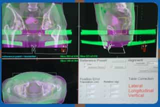 Basavatarakam Indo American Cancer Hospital & Research Institute Imaging in India