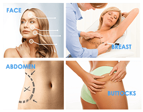 Bulent-Masterclass-Liposculpture-Geneva-Switzerland