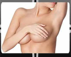 Breast Surgical Procedure