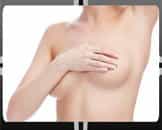Breast Reduction Procedures