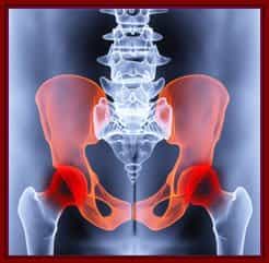 Cemented vs Uncemented Hip Replacement