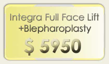 Full Face Lift Blepharoplasty Mexico