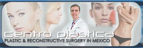 Centro Plastica | Plastic and Reconstructive Surgery in Guadalajara, Mexico