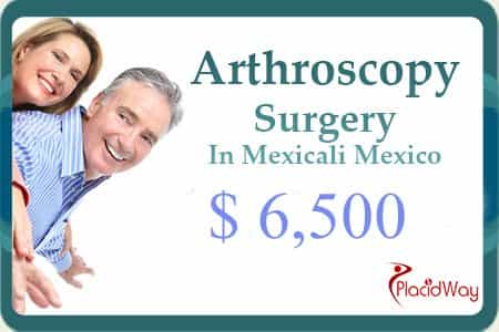 Shoulder Arthritis Treatment Cost in Mexico