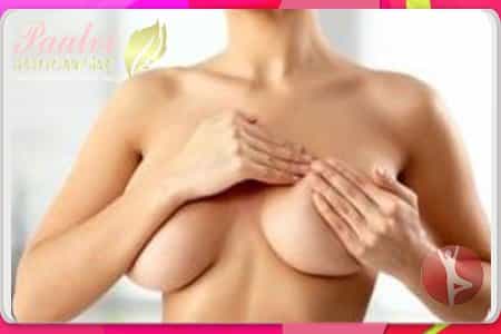 Top Breast Enhancement Surgery in Mumbai