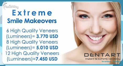 Lumineer Veneers Cost in Istanbul Turkey Price