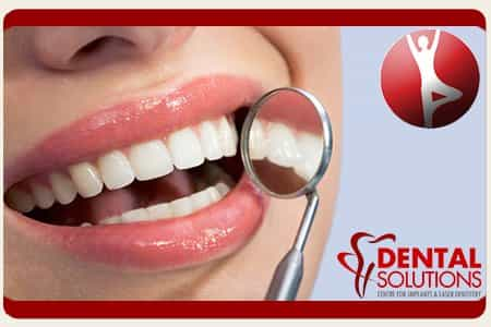 Types of Dental Bridges in Bangalore India