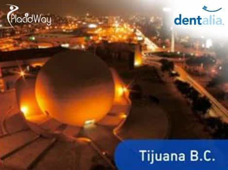 Dental Treatments in Tijuana Mexico - Dentalia