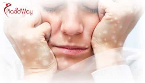 Schizophrenia - Treatment in Russia