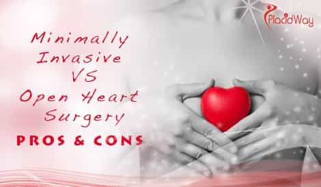 Minimally Invasive Surgery versus Open Heart Surgery - Pros & Cons