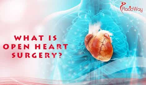 Define Open Heart Surgery