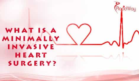 What is a Minimally Invasive Heart Surgery?