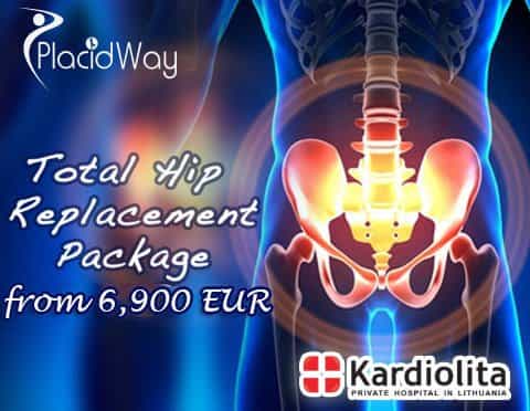 Total Hip Replacement Package Price in Lithuania