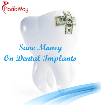 Dental Implants Cost