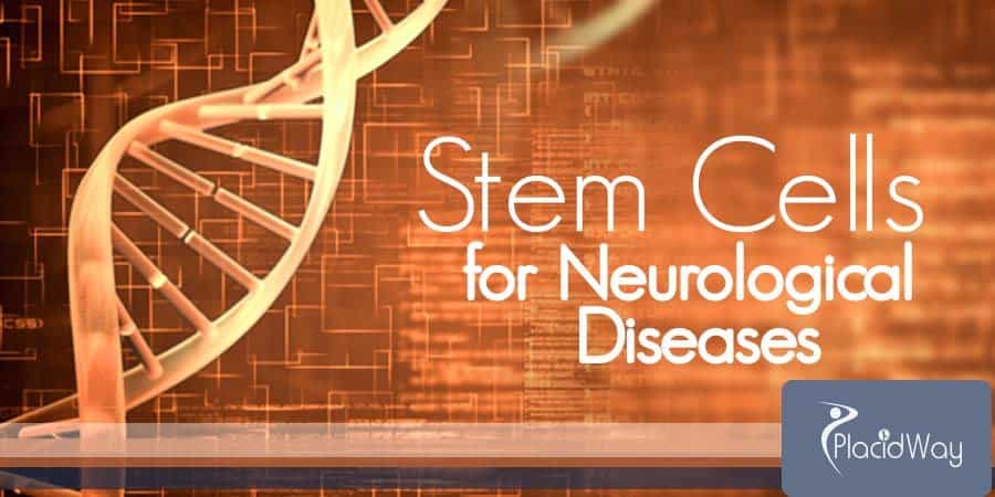 Neurological Diseases Stem Cells Treatment 