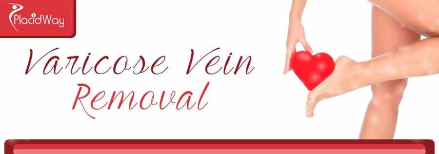 Varicose Vein Removal Surgery