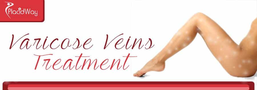 Varicose Veins Treatment Abroad