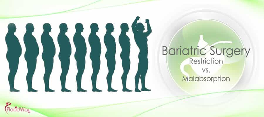 Bariatric Surgery