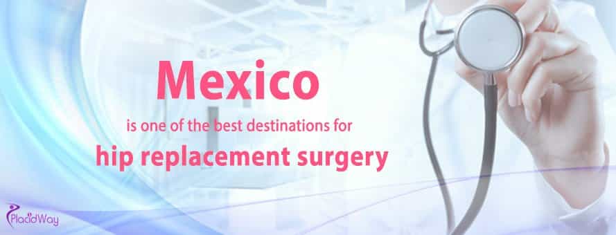 Why Choose Mexico for Hip Replacement?