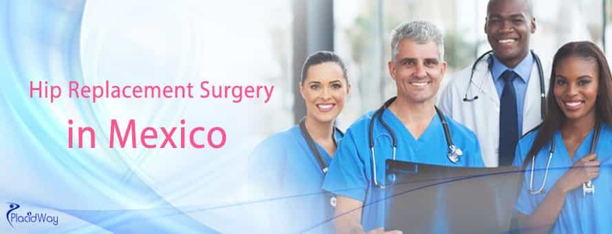 Hip Replacement Surgery in Mexico