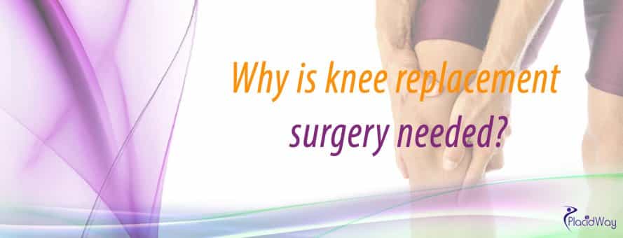 Orthopedic Surgery In Asia, Knee Replacement,  Knee Surgery Abroad