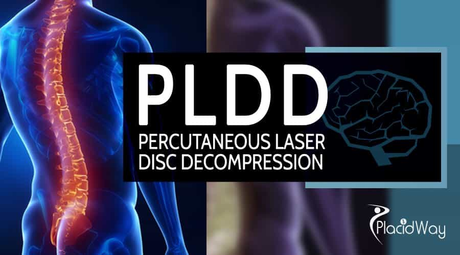 Percutaneous Laser Disc Decompression