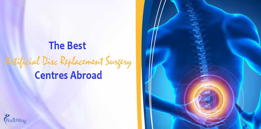 Artificial Disc Replacement Surgery Centres Abroad, Back Pain Treatment