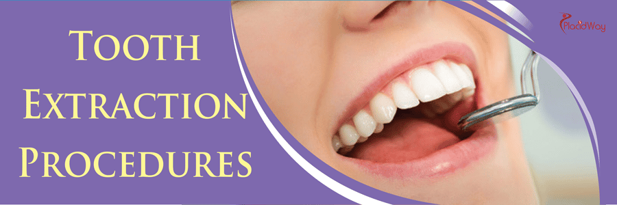 Dentistry - Tooth Extraction Treatment Overview