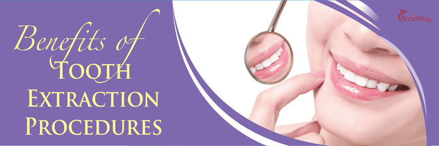 Dentistry - Benefits of Tooth Extraction Treatment