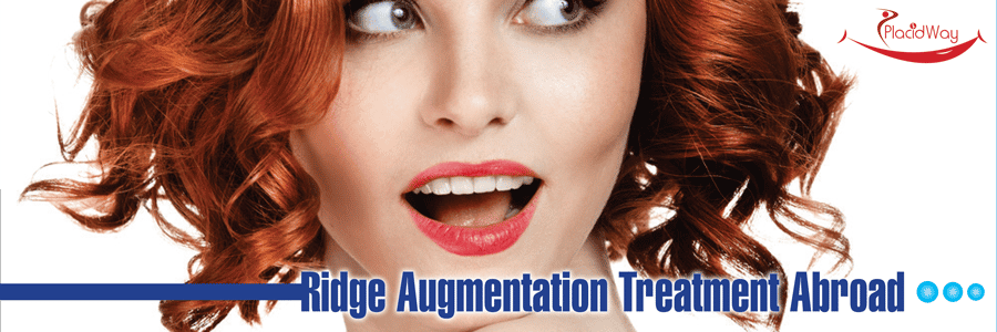 Ridge-Augmentation-Treatment-Abroad