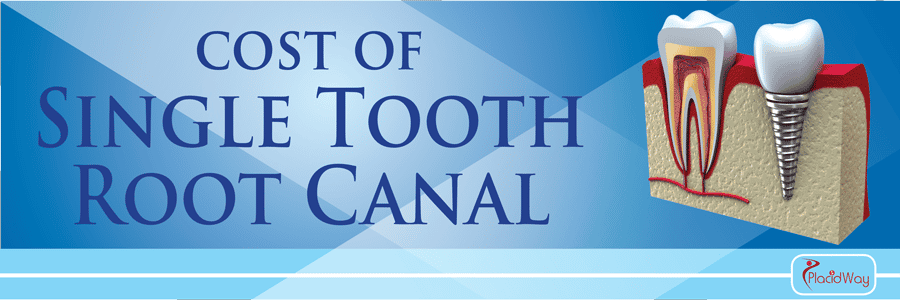 Root-Canal-(per-tooth)-Treatment-Abroad-Cost