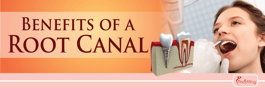 Root-Canal-Treatment-Abroad Benefits