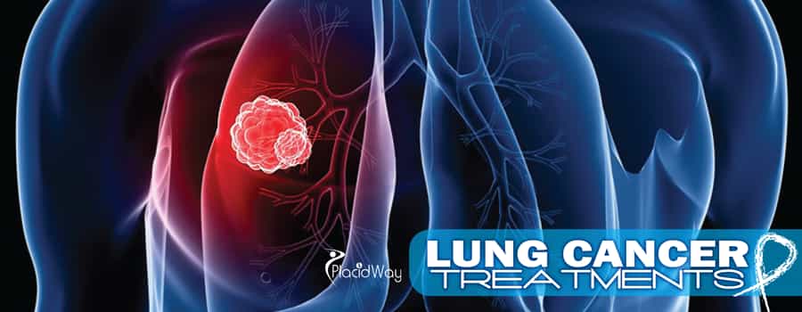 Lung-Cancer-Treatments