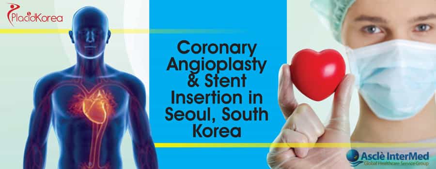 Coronary Angioplasty & Stent Insertion in Seoul, South Korea
