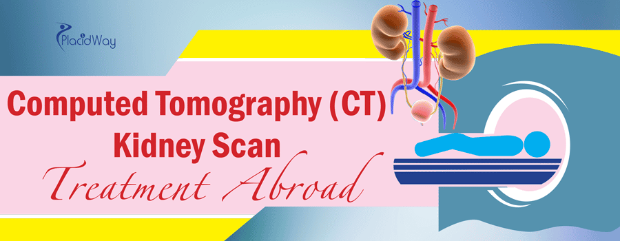 Computed Tomography (CT) Kidney Scan