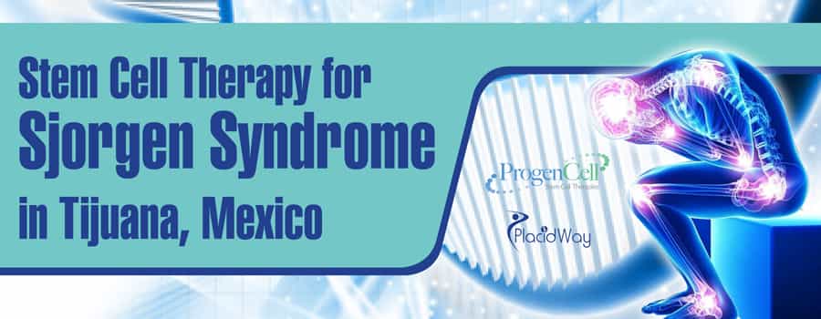 Stem Cell Therapy for Sjorgen Syndrome in Tijuana, Mexico