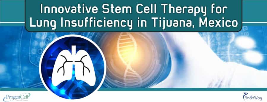 Stem Cell Therapy for Lung Insufficiency in Tijuana, Mexico