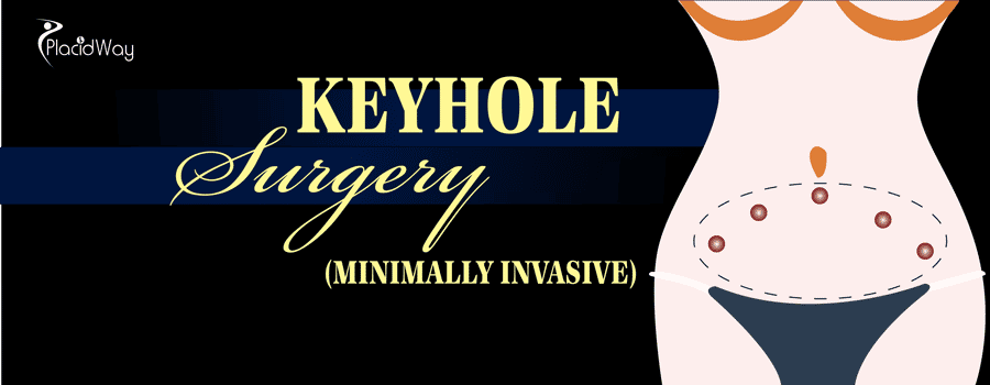 Keyhole Surgery