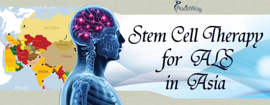 Stem Cell Therapy for ALS in Asia