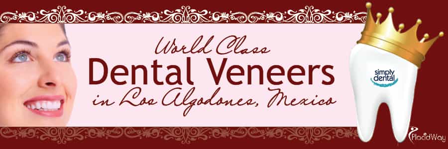 World Class Dental Veneers in Los Algodones, Mexico