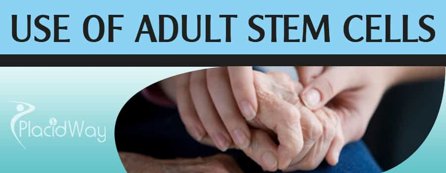 Uses of Adult Stem Cell Therapy