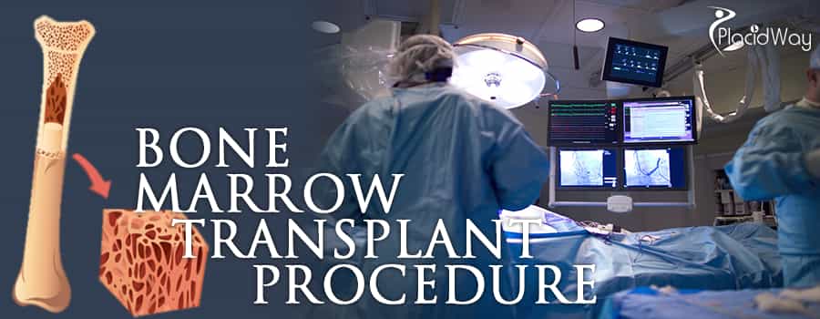 Bone Marrow Transplant Procedure