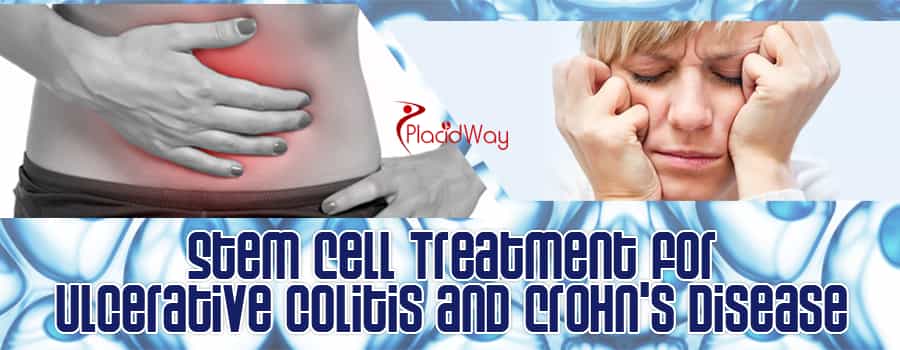 Stem Cell Treatments for Ulcerative Colitis and Crohn's Disease