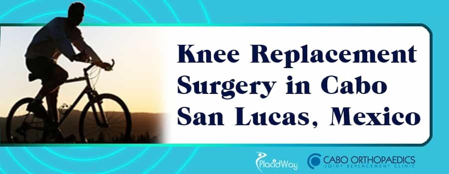 Knee Replacement Surgery in Cabo San Lucas, Mexico