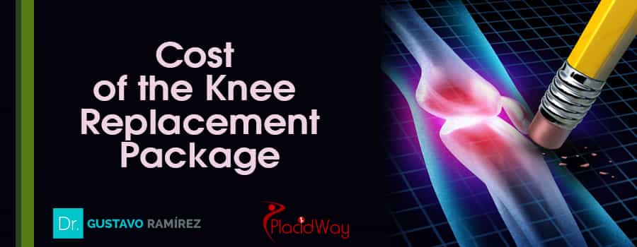 Cost of Knee Replacement Package in Mexico
