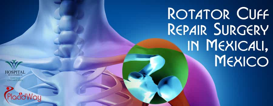 Rotator Cuff Repair Surgery in Mexicali, Mexico