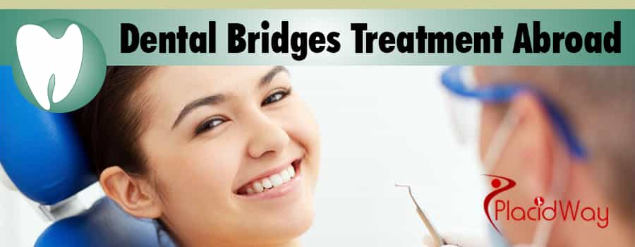 Dental Bridges Treatment Abroad Banner Image